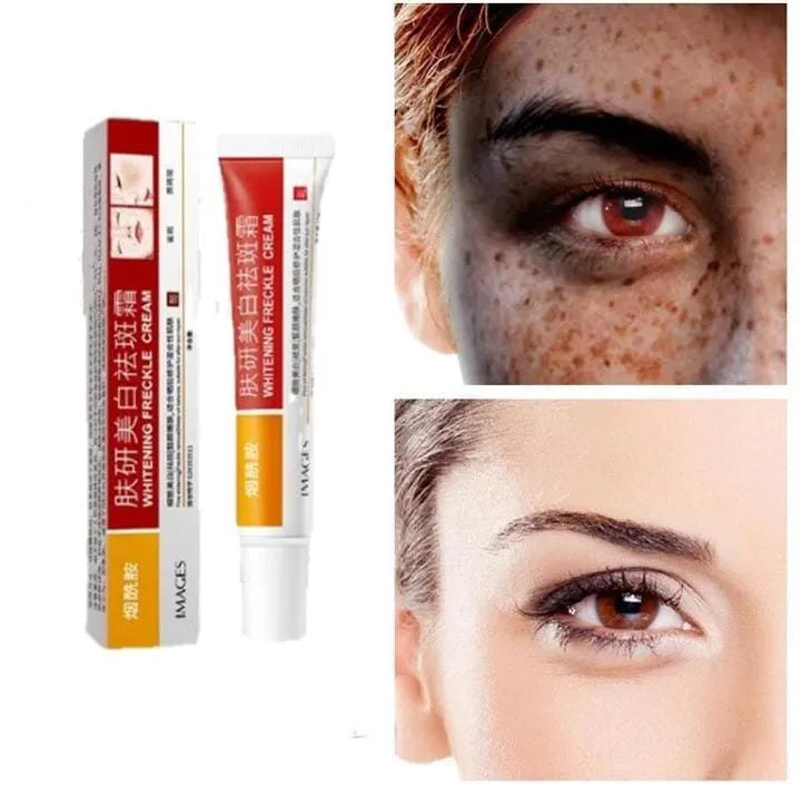 Images Anti-Freckle Cream For Brighten Skin 15G Skin Kojic Acid Skin Repair Cream | Skin Care Products | Freckles, Dark Spots & Melasma Treatment | Face Brightening & Even Skin Tone